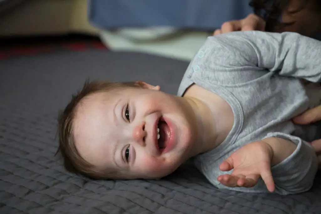A baby boy with down syndrome